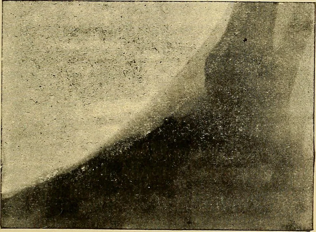 An illustration from Traité de radiographie médicale et scientifique : cours libre professé a l'écolepratique de la Faculté de Médecine de Paris, deuxième semestre de 1896-1897, 1897, leaf 372