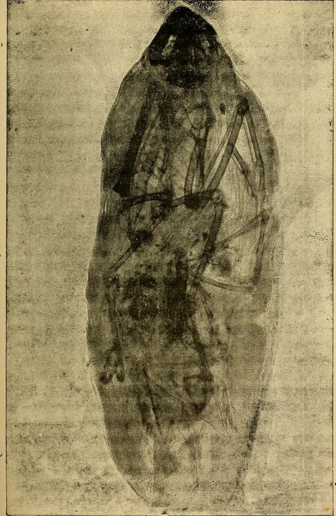 An illustration from Traité de radiographie médicale et scientifique : cours libre professé a l'écolepratique de la Faculté de Médecine de Paris, deuxième semestre de 1896-1897, 1897, leaf 420