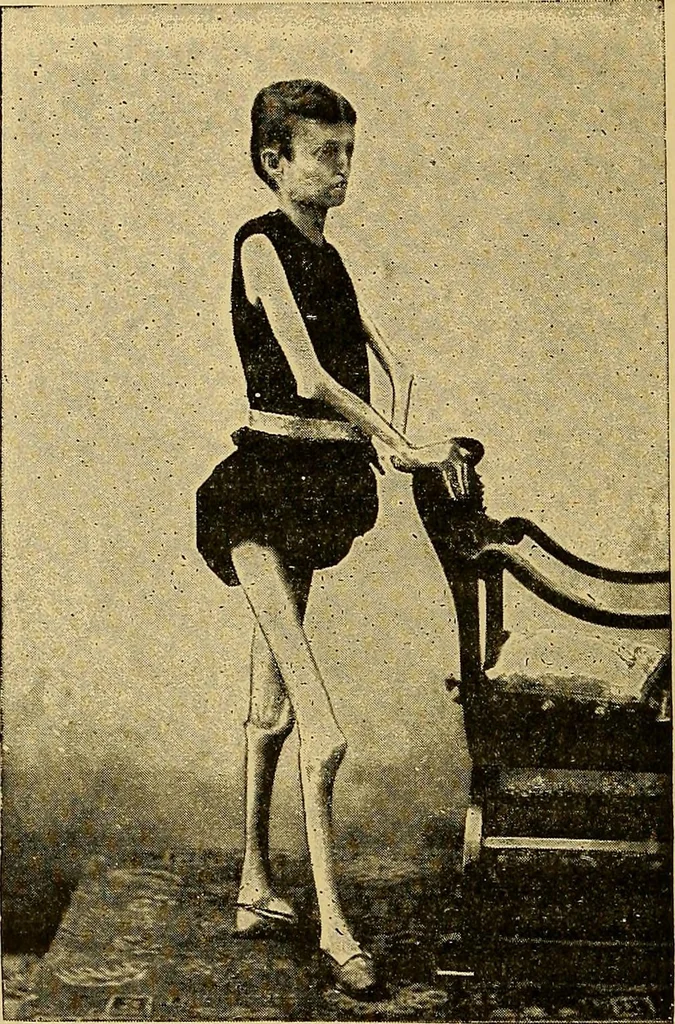 An illustration from Traité de radiographie médicale et scientifique : cours libre professé a l'écolepratique de la Faculté de Médecine de Paris, deuxième semestre de 1896-1897, 1897, leaf 423