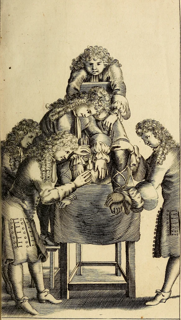 An illustration from Traite' de la lithotomie, ou, De l'extraction de la pierre, hors de la vessie : enrichy de figures necessaires pour representer la maniére de sonder, les instrumens propres, le malade dans l'operation : la ponction du perinée, & les differentes methodes de tirer la pierre : avec les appareils, les remedes preservatifs du calcul, & les medicamens pour les taillez, 1686, leaf 128