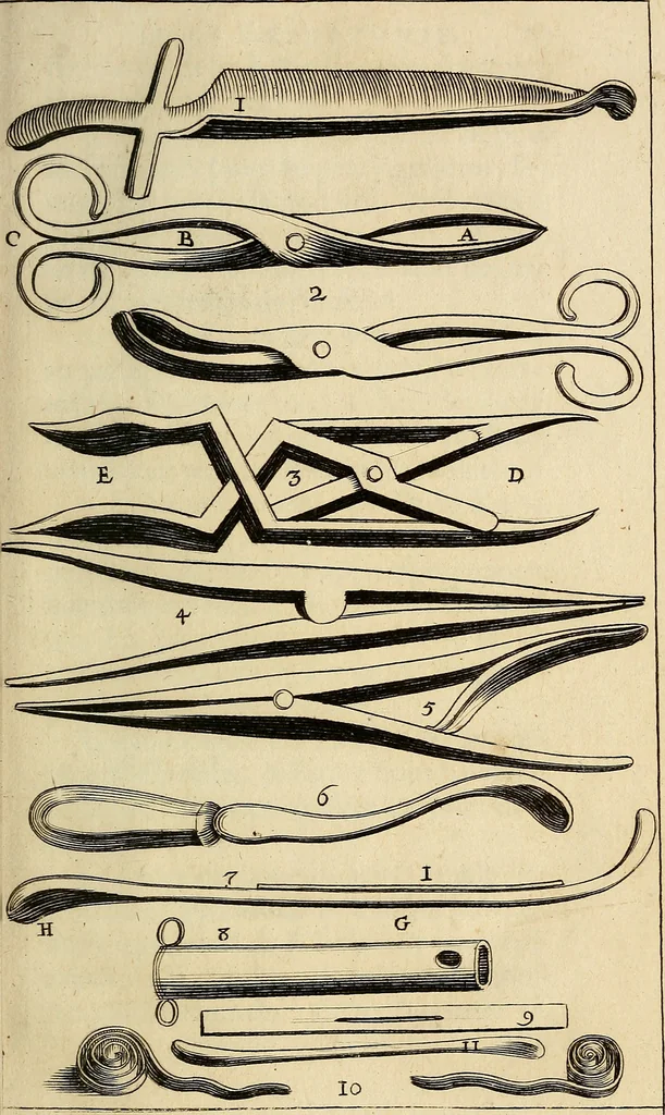 An illustration from Traite' de la lithotomie, ou, De l'extraction de la pierre, hors de la vessie : enrichy de figures necessaires pour representer la maniére de sonder, les instrumens propres, le malade dans l'operation : la ponction du perinée, & les differentes methodes de tirer la pierre : avec les appareils, les remedes preservatifs du calcul, & les medicamens pour les taillez, 1686, leaf 76