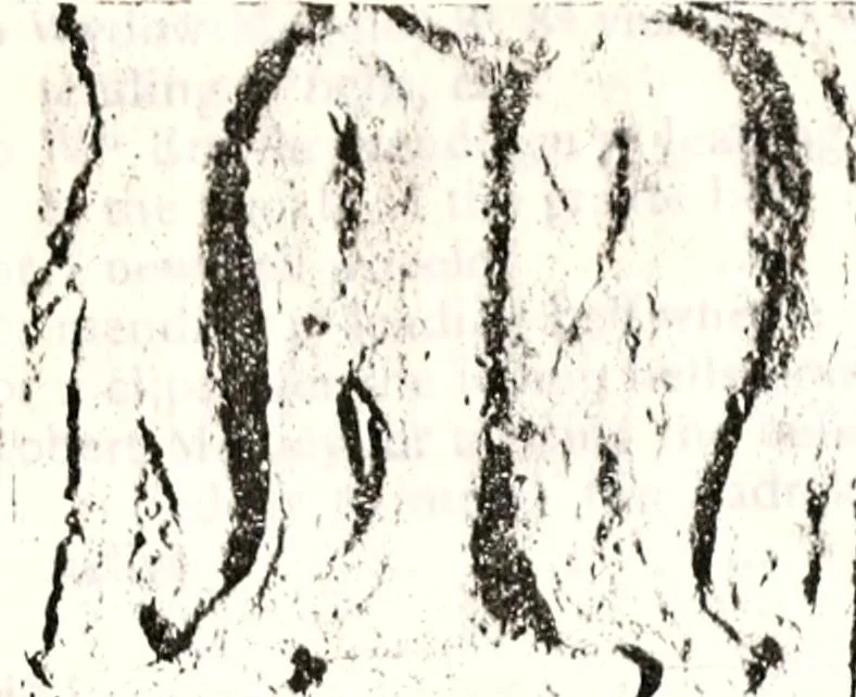 An illustration from Transactions of the Shropshire Archaeological and Natural History Society, 1878, leaf 126