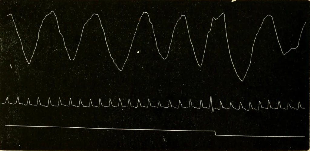 An illustration from Treatment by hypnotism and suggestion : or, psycho-therapeutics, 1900, leaf 277