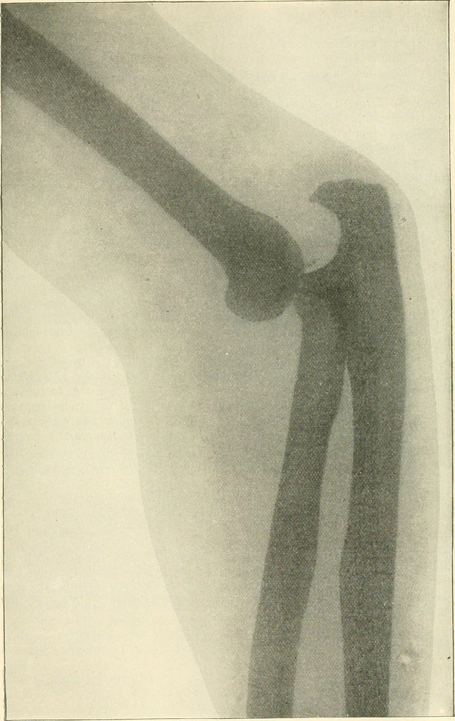 An illustration from Triumphs and wonders of the 19th century, a volume of original, historic and descriptive writings showing the many and marvellous achievements which distinguish an hundred years of material, intellectual, social and moral progress, 1901, leaf 670