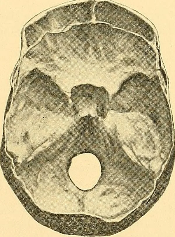 An illustration from Études biologiques sur les géants, 1904, leaf 140