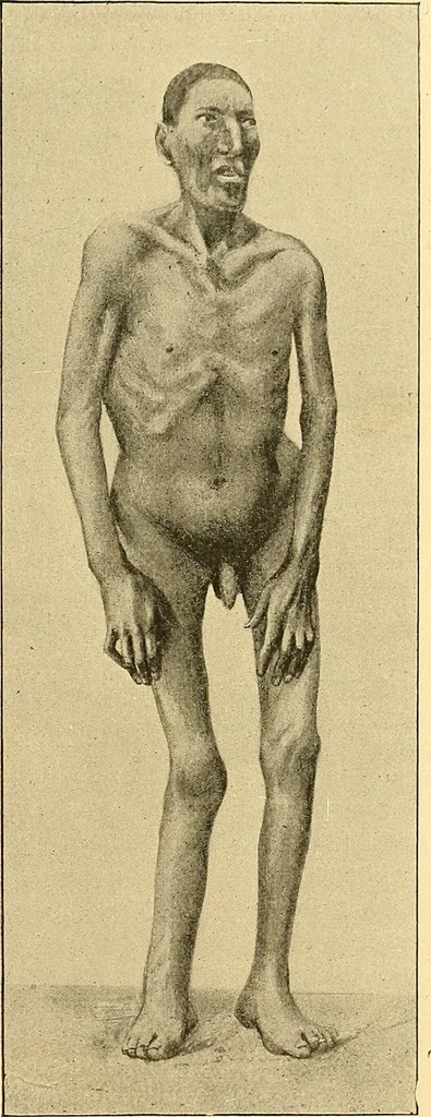 An illustration from Études biologiques sur les géants, 1904, leaf 144