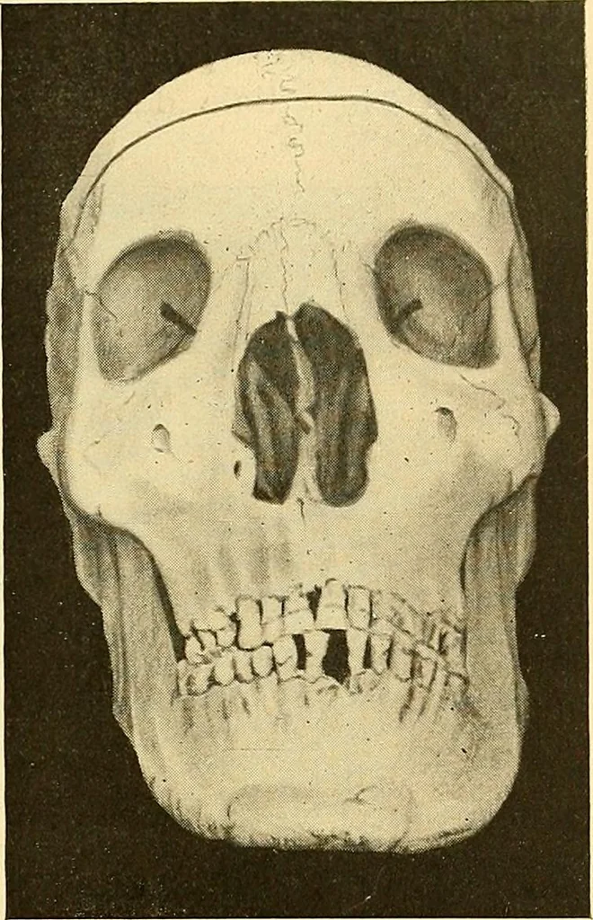 An illustration from Études biologiques sur les géants, 1904, leaf 150
