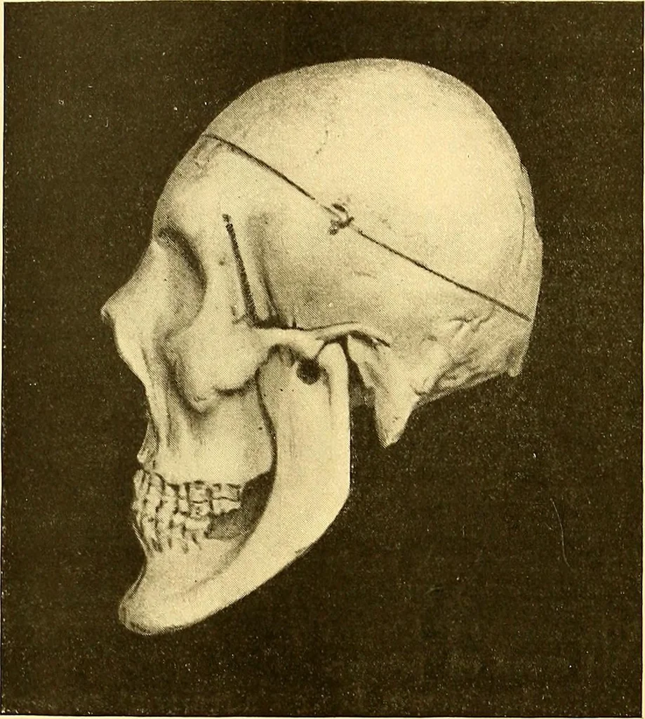 An illustration from Études biologiques sur les géants, 1904, leaf 151