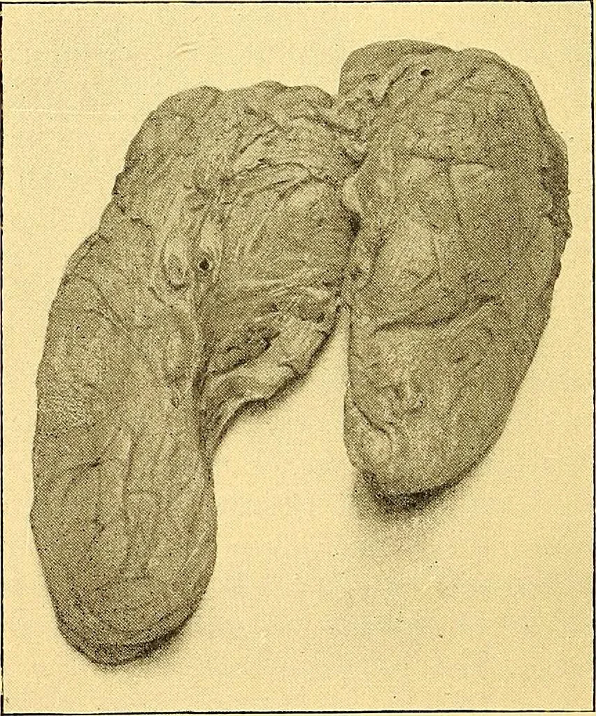 An illustration from Études biologiques sur les géants, 1904, leaf 191
