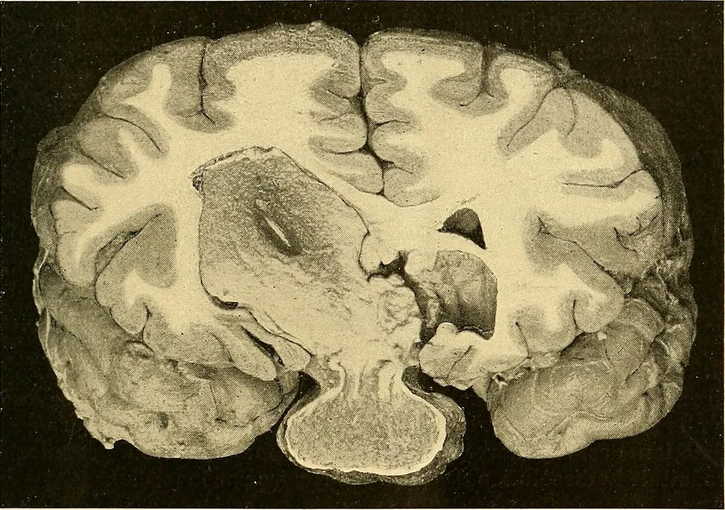 An illustration from Études biologiques sur les géants, 1904, leaf 194