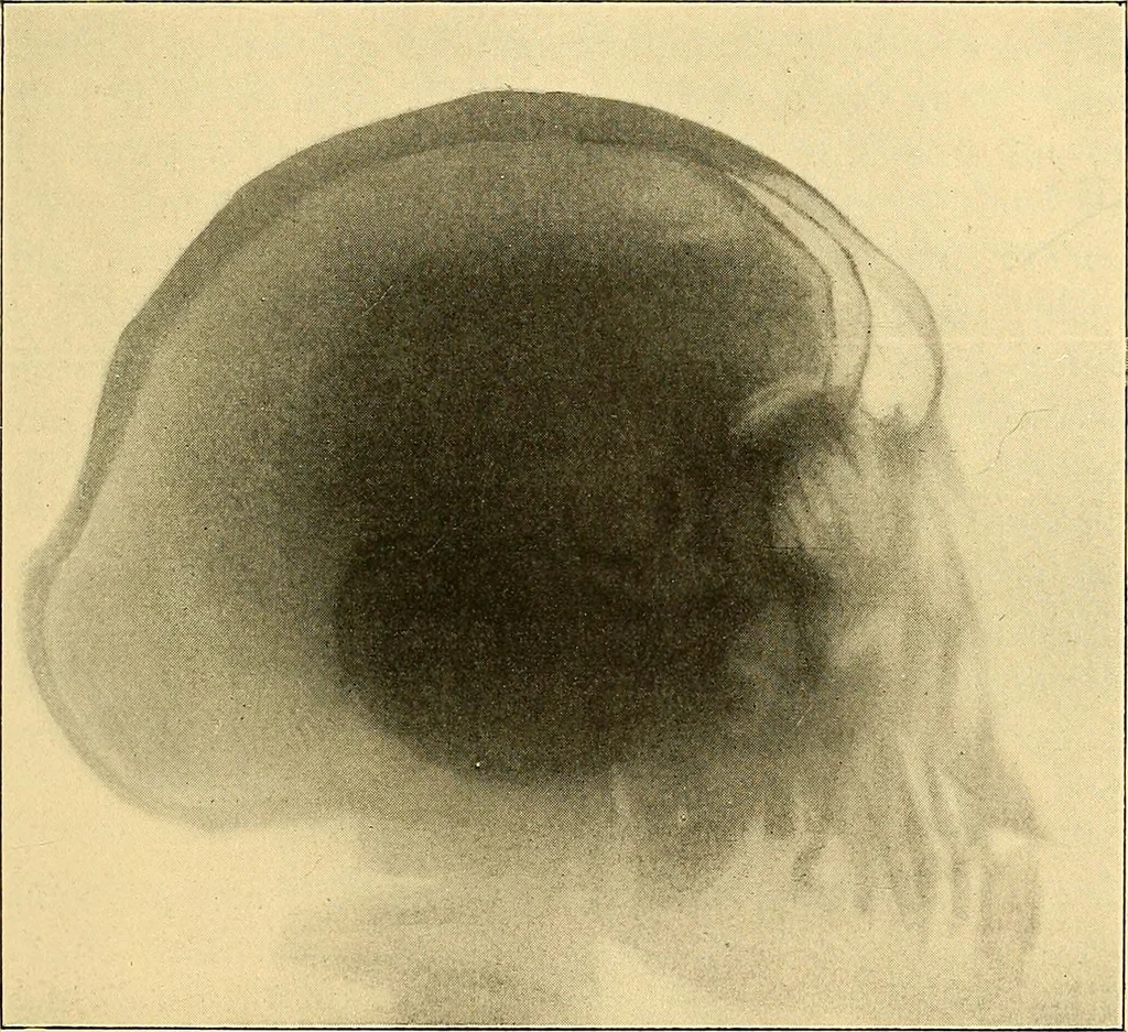 An illustration from Études biologiques sur les géants, 1904, leaf 212