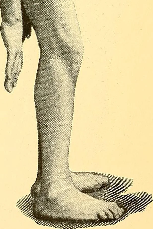 An illustration from Études biologiques sur les géants, 1904, leaf 239