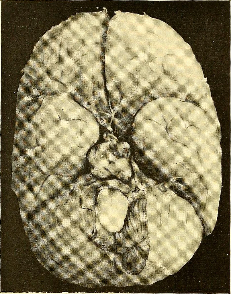An illustration from Études biologiques sur les géants, 1904, leaf 251