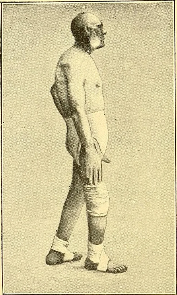 An illustration from Études biologiques sur les géants, 1904, leaf 255