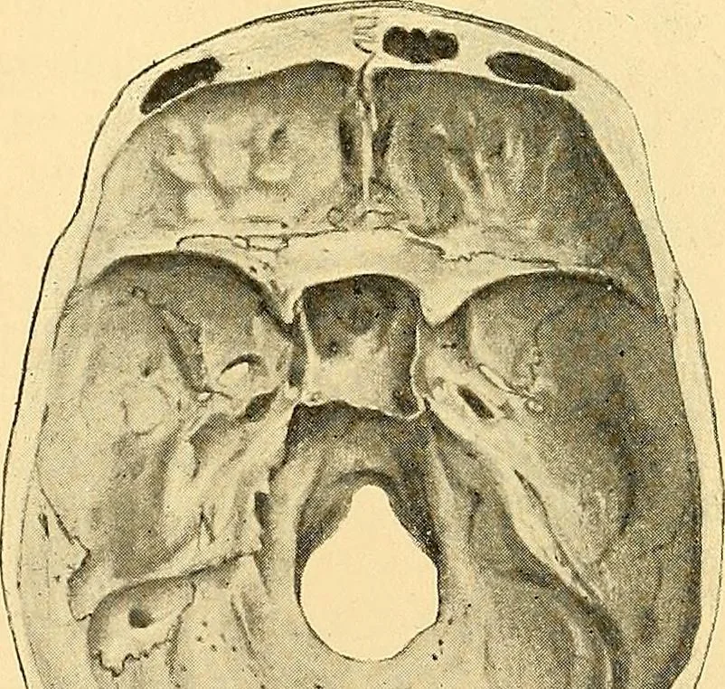 An illustration from Études biologiques sur les géants, 1904, leaf 266