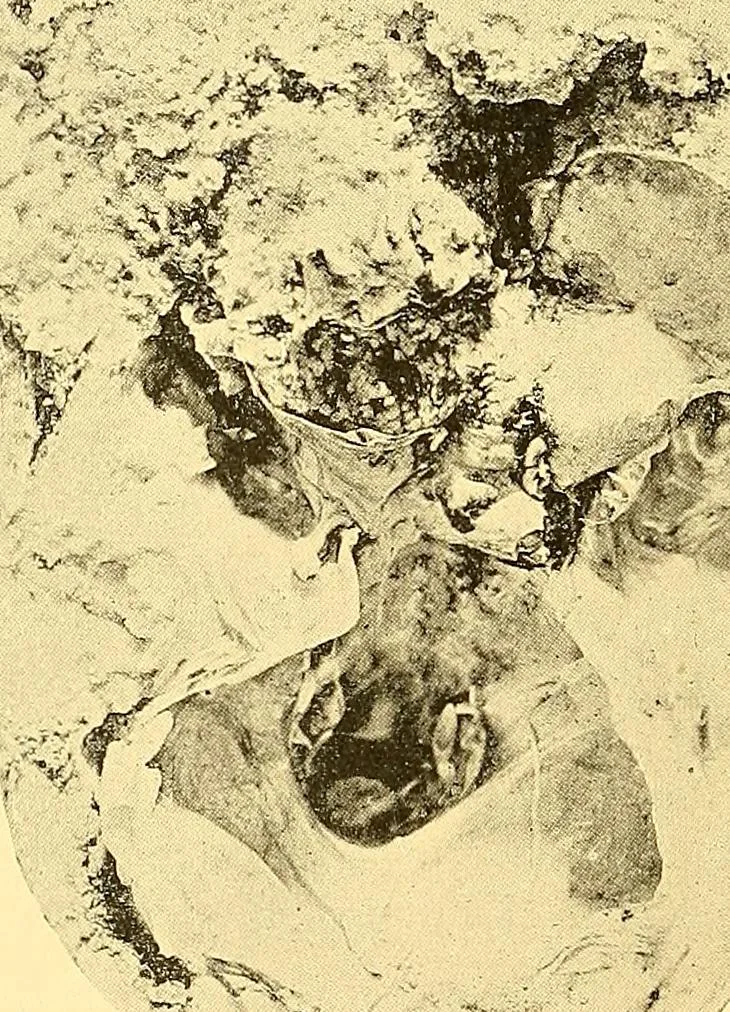 An illustration from Études biologiques sur les géants, 1904, leaf 283
