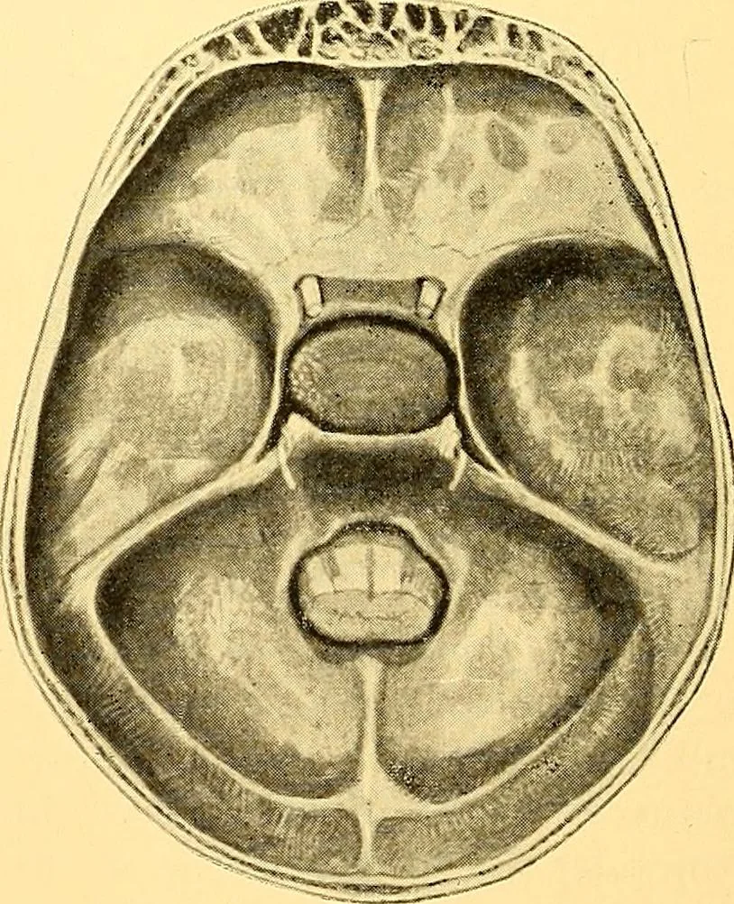An illustration from Études biologiques sur les géants, 1904, leaf 287
