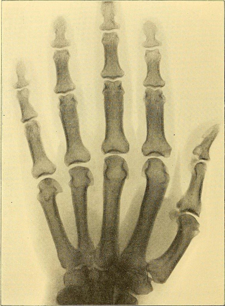 An illustration from Études biologiques sur les géants, 1904, leaf 393
