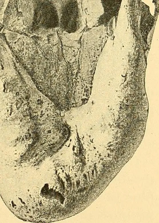 An illustration from Études biologiques sur les géants, 1904, leaf 434