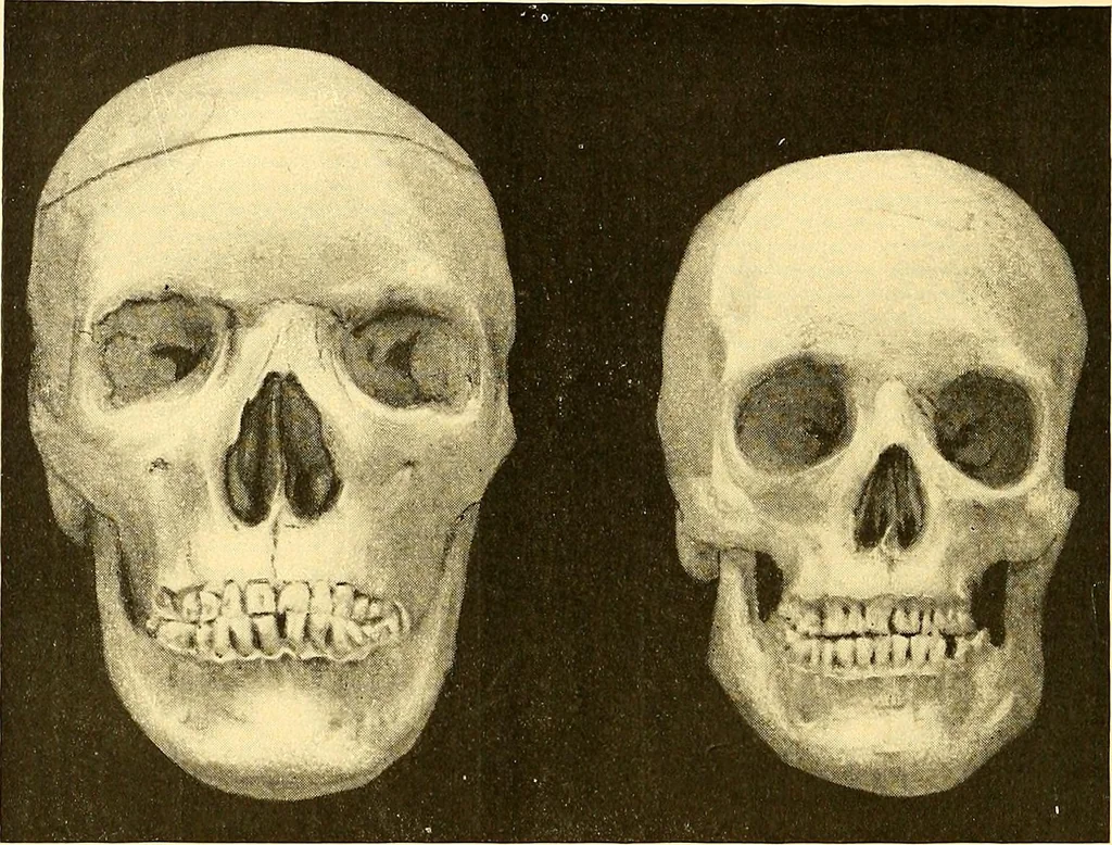 An illustration from Études biologiques sur les géants, 1904, leaf 441