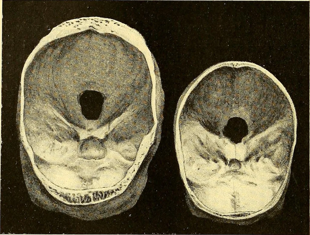 An illustration from Études biologiques sur les géants, 1904, leaf 443