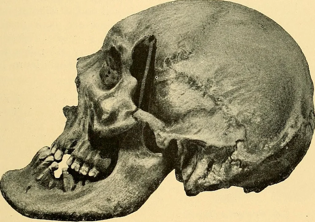An illustration from Études biologiques sur les géants, 1904, leaf 462