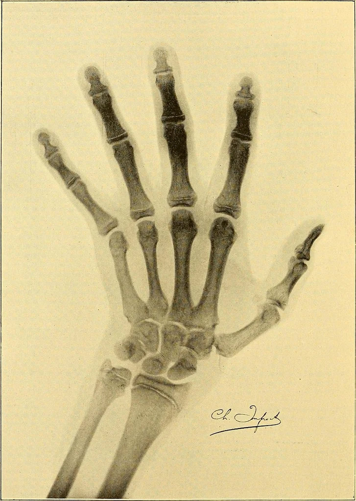 An illustration from Études biologiques sur les géants, 1904, leaf 91