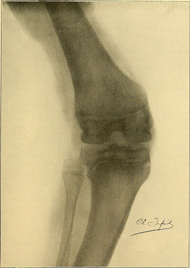 An illustration from Études biologiques sur les géants, 1904, leaf 92