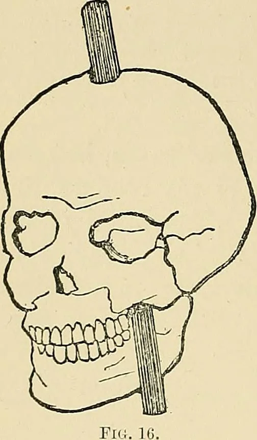 An illustration from A vindication of phrenology, 1894, leaf 179