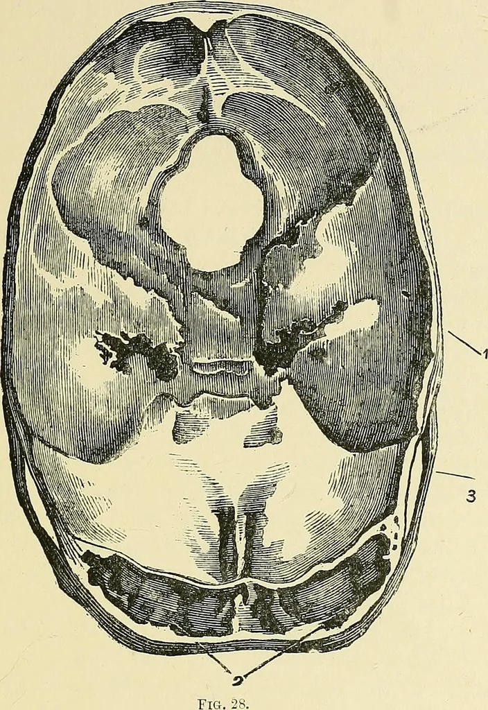 An illustration from A vindication of phrenology, 1894, leaf 276
