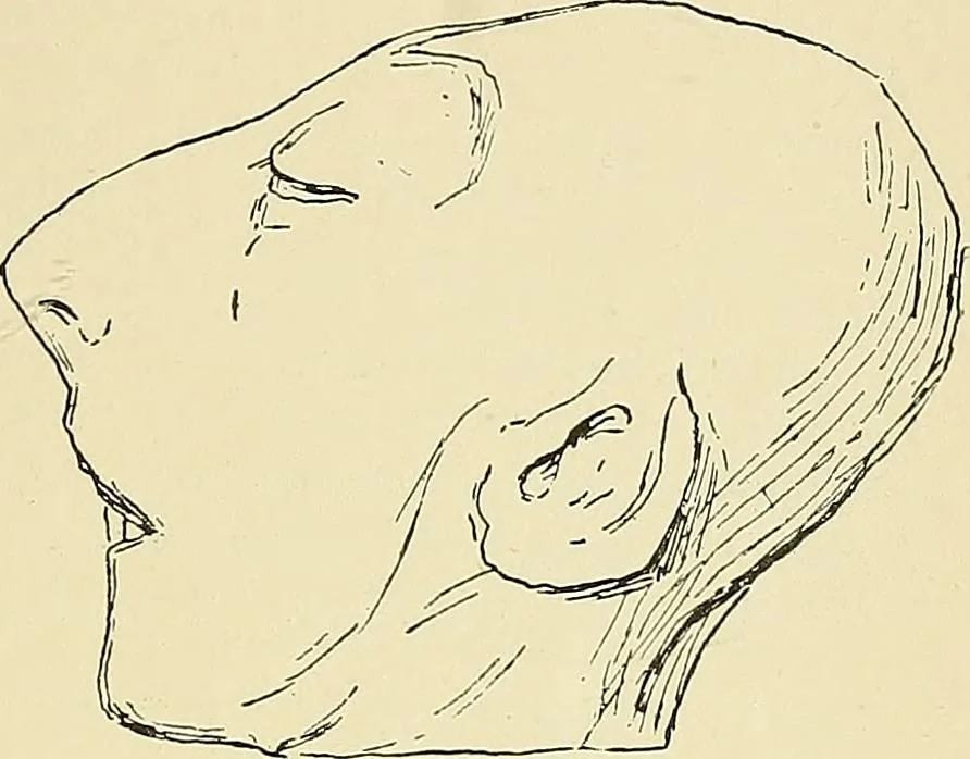 An illustration from A vindication of phrenology, 1894, leaf 426