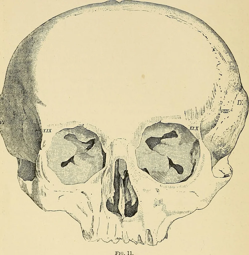 An illustration from A vindication of phrenology, 1894, leaf 83