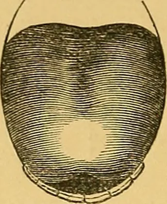 An illustration from Visible speech, the science of universal alphabets, : or Self-interpreting physiological letters, for the writing of all languages in one alphabet ; illustrated by tables, diagrams, and examples, 1867, leaf 77