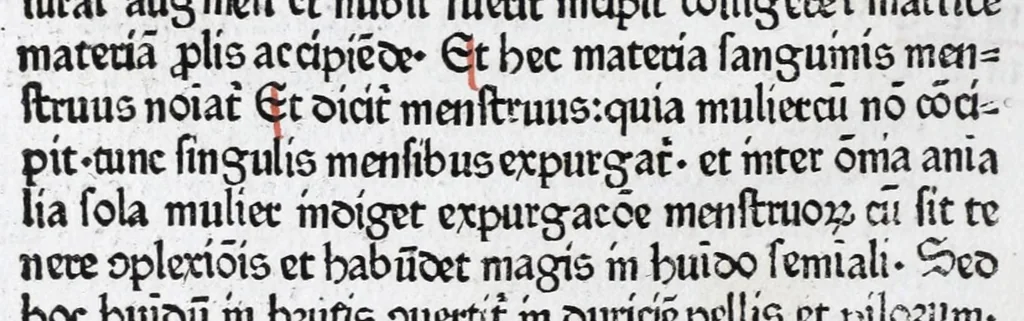 An illustration from Vocabularius rerum, leaf 34