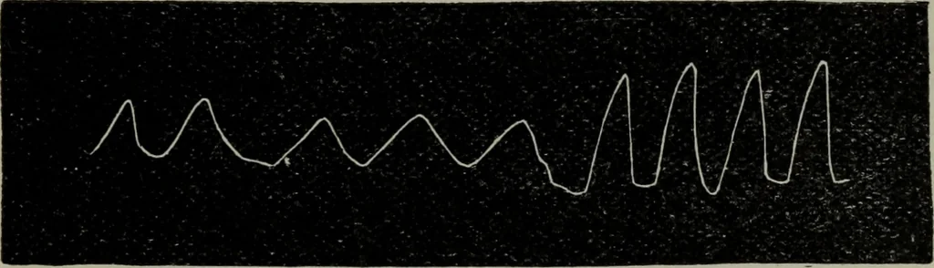 An illustration from The well-dressed woman: a study in the practical application to dress of the laws of health, art, and morals, 1893, leaf 104