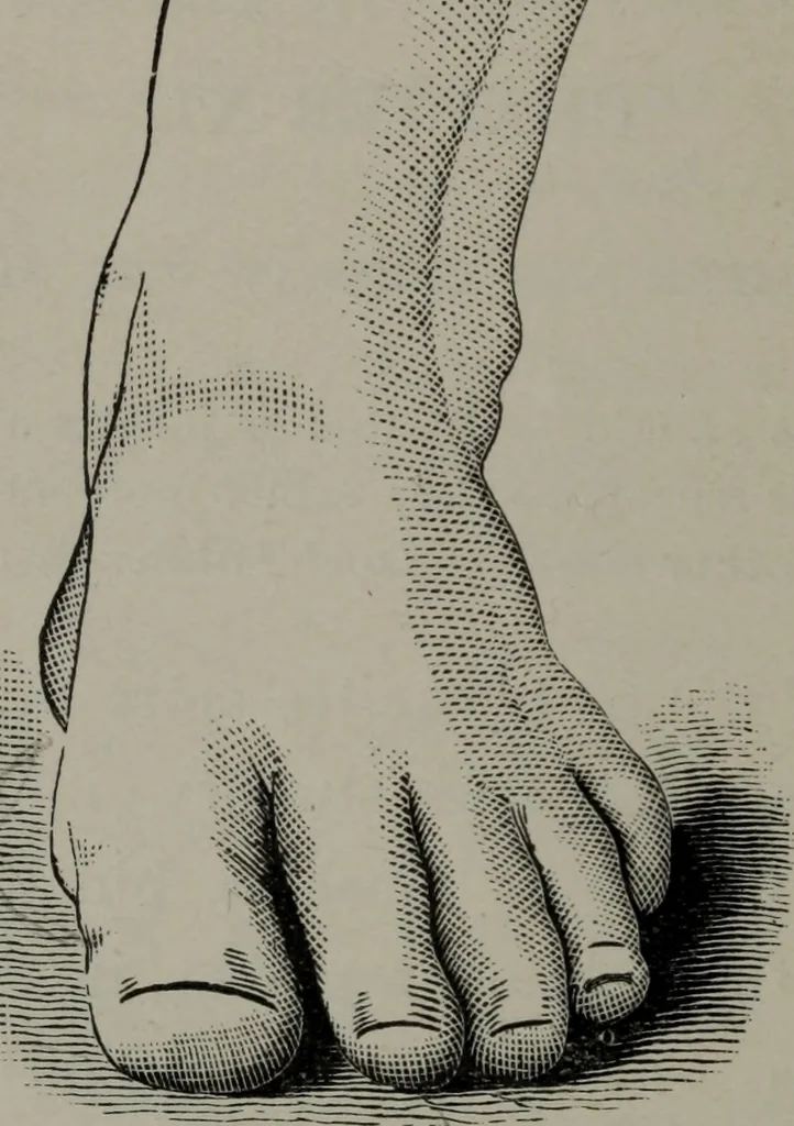 An illustration from The well-dressed woman: a study in the practical application to dress of the laws of health, art, and morals, 1893, leaf 187