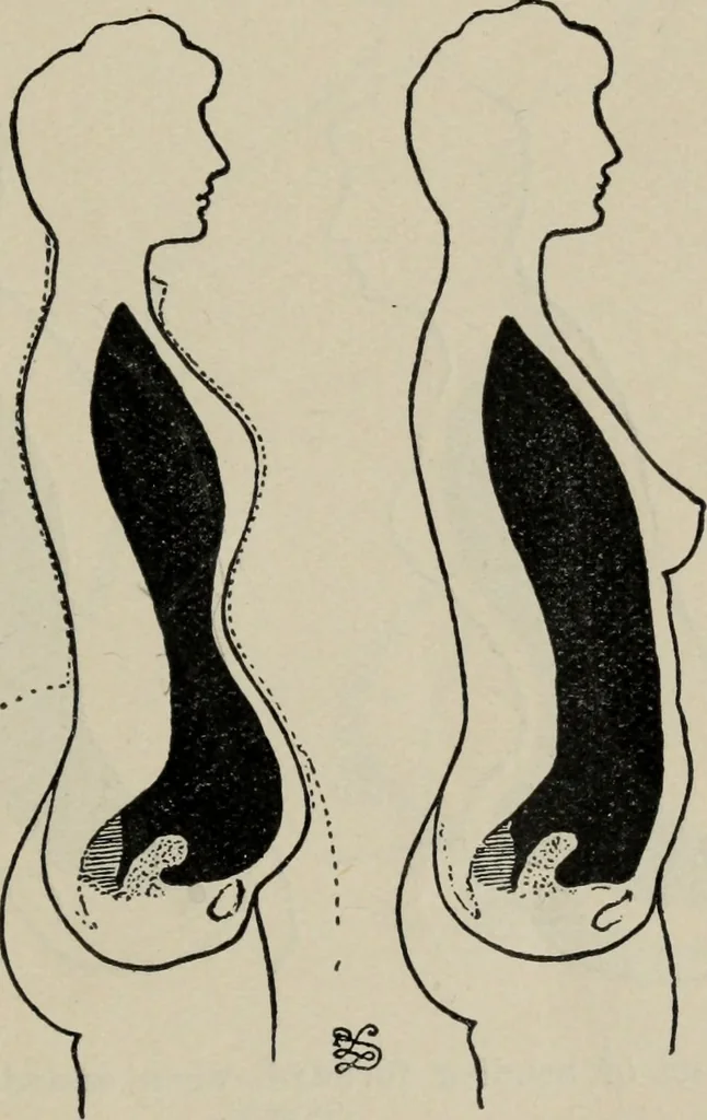 An illustration from The well-dressed woman: a study in the practical application to dress of the laws of health, art, and morals, 1893, leaf 50