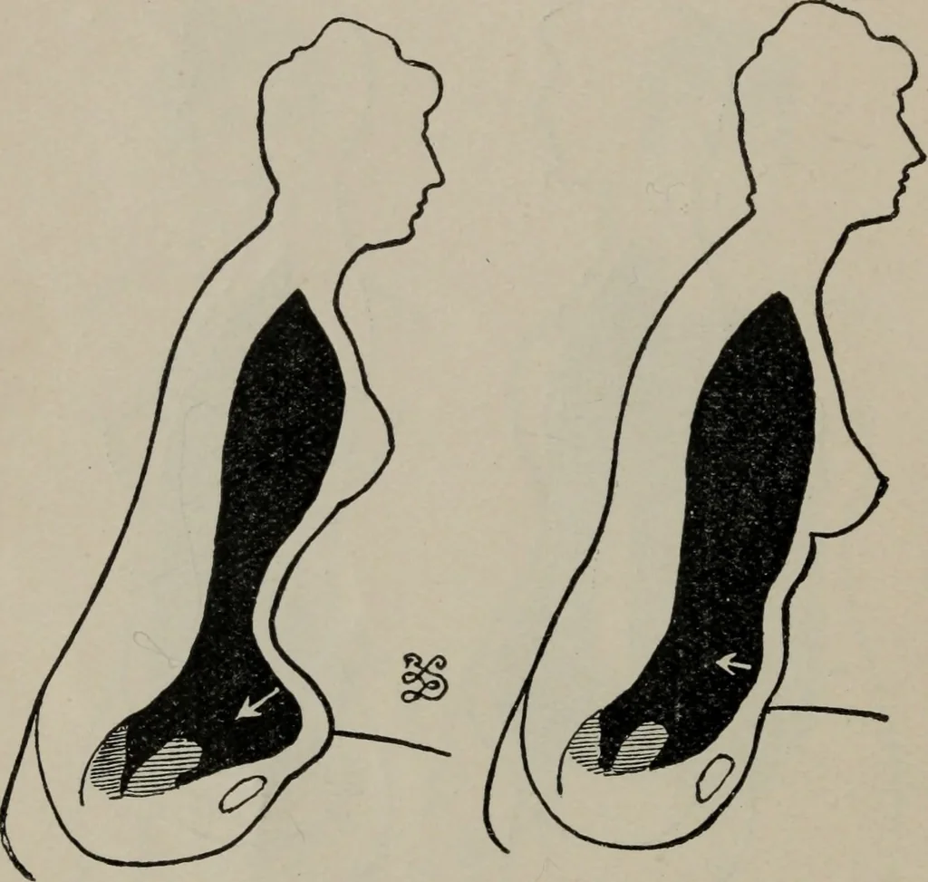An illustration from The well-dressed woman: a study in the practical application to dress of the laws of health, art, and morals, 1893, leaf 51