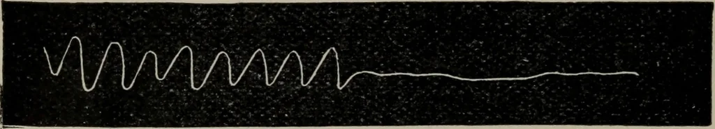 An illustration from The well-dressed woman: a study in the practical application to dress of the laws of health, art, and morals, 1893, leaf 65