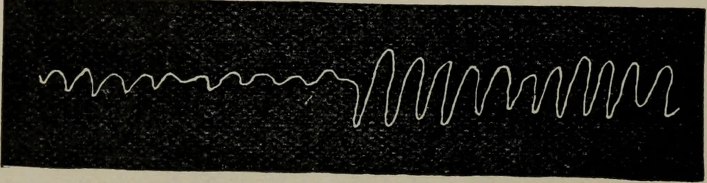An illustration from The well-dressed woman: a study in the practical application to dress of the laws of health, art, and morals, 1893, leaf 65
