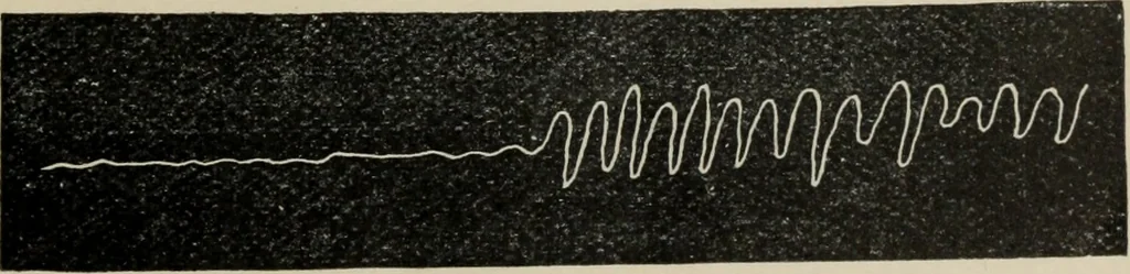 An illustration from The well-dressed woman: a study in the practical application to dress of the laws of health, art, and morals, 1893, leaf 66