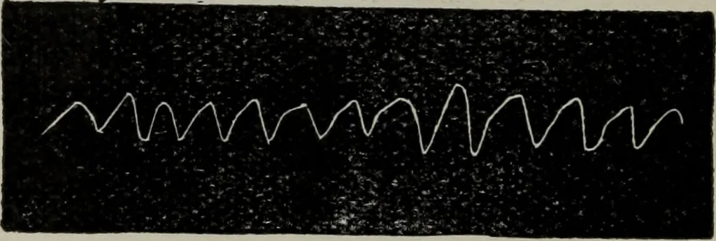 An illustration from The well-dressed woman: a study in the practical application to dress of the laws of health, art, and morals, 1893, leaf 67
