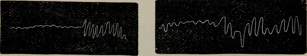 An illustration from The well-dressed woman: a study in the practical application to dress of the laws of health, art, and morals, 1893, leaf 69
