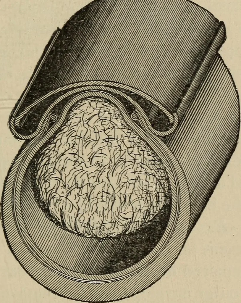 An illustration from Wheels and wheeling; an indispensable handbook for cyclists, with over two hundred illustrations, 1892, leaf 314
