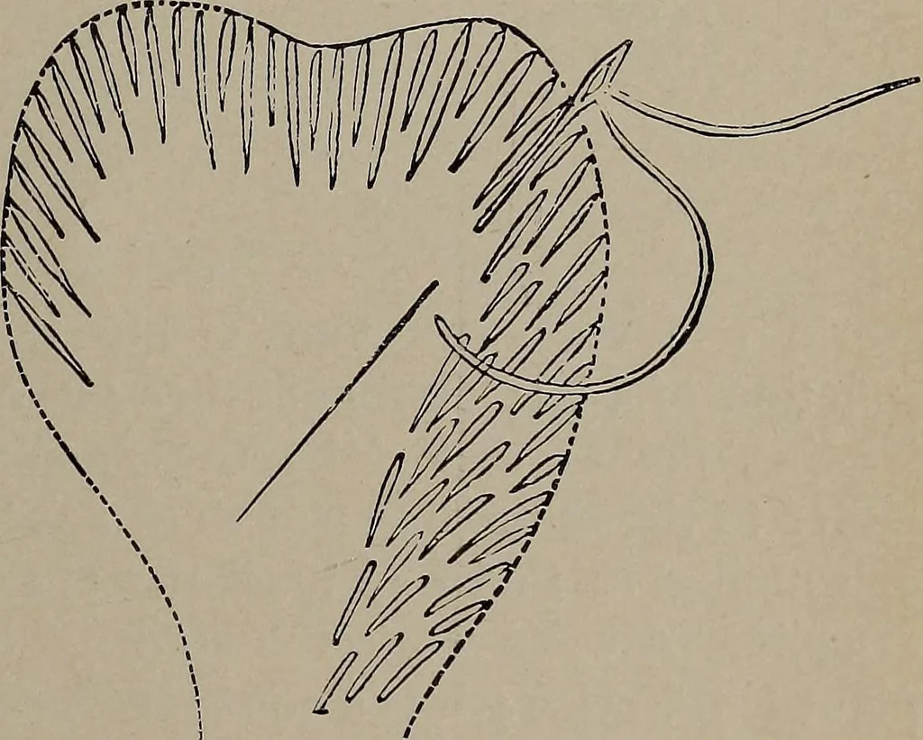 An illustration from The woman's book : dealing practically with the modern conditions of home-life, self-support, education, opportunties, and every-day problems, 1894, leaf 254