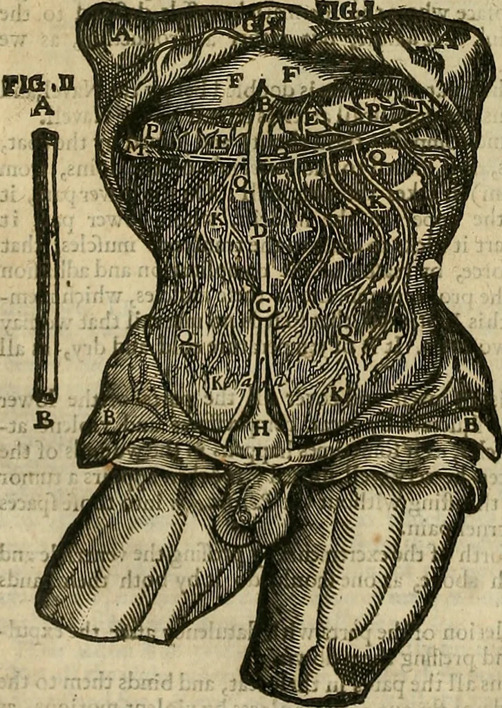 An illustration from The workes of that famous chirurgion Ambrose Parey :, 1649, leaf 103