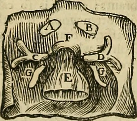An illustration from The workes of that famous chirurgion Ambrose Parey :, 1649, leaf 157