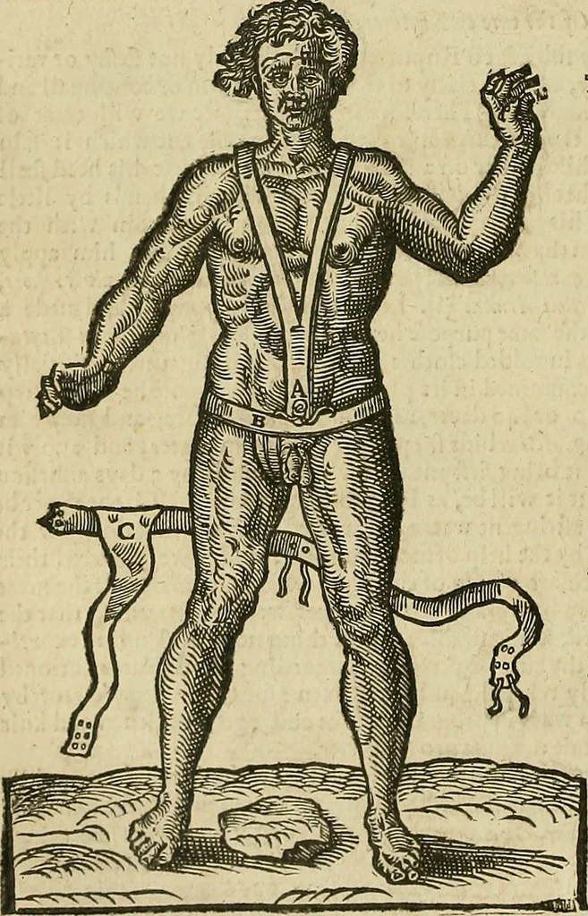 An illustration from The workes of that famous chirurgion Ambrose Parey :, 1649, leaf 265