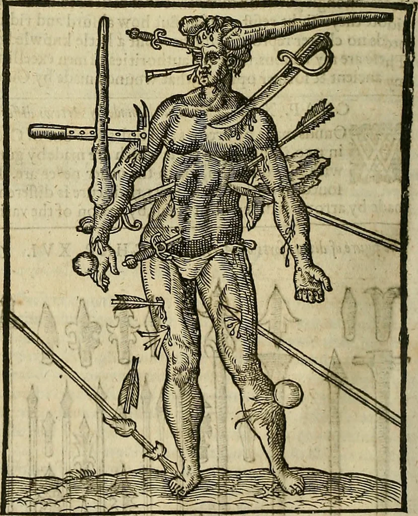 An illustration from The workes of that famous chirurgion Ambrose Parey :, 1649, leaf 353