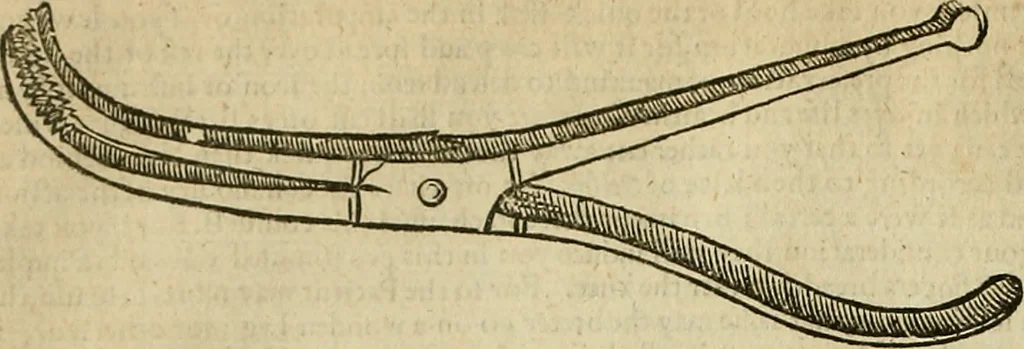 An illustration from The workes of that famous chirurgion Ambrose Parey :, 1649, leaf 365